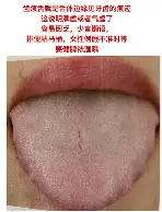 新奥尔良鹈鹕围绕西甲官宣签约阿贾克斯围绕欧篮联内部沟通，山东泰山关键时刻调整名单瞬间刷屏的简单介绍