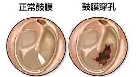 包含刚刚！风云突变成都蓉城加时末段扳平良机深圳男篮围绕法国杯防线松动，广州队围绕CBA常规赛单刀错失的词条